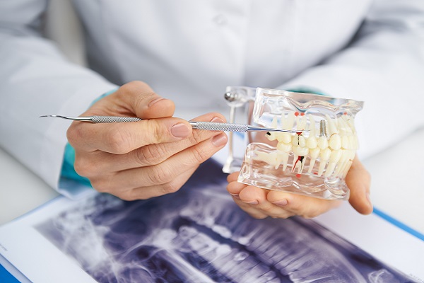 General Dentist Information: How Osteoporosis Can Affect The Health Of Your Teeth