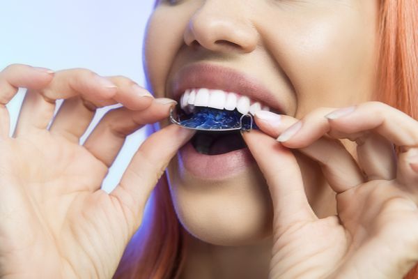 Ways To Help You Adjust To Clear Aligners