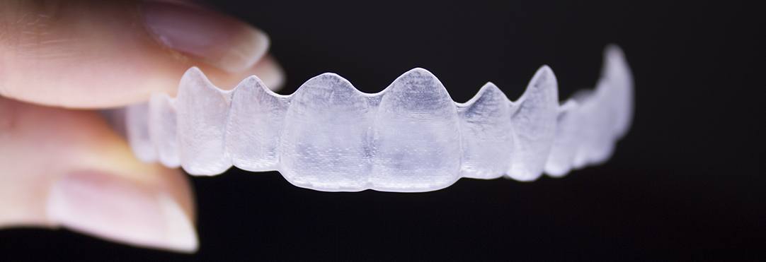 Rockville Clear Aligners