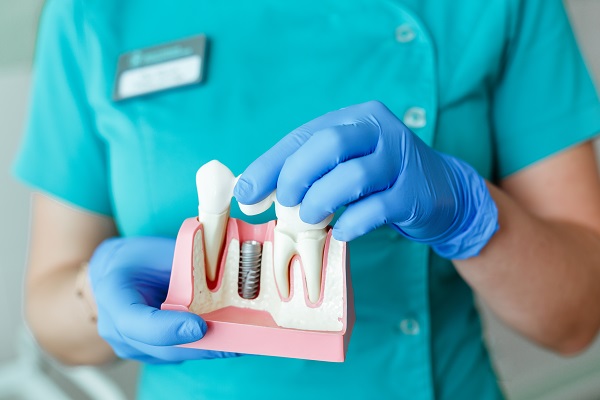 Cosmetic Dentistry:   Benefits Of Dental Implants