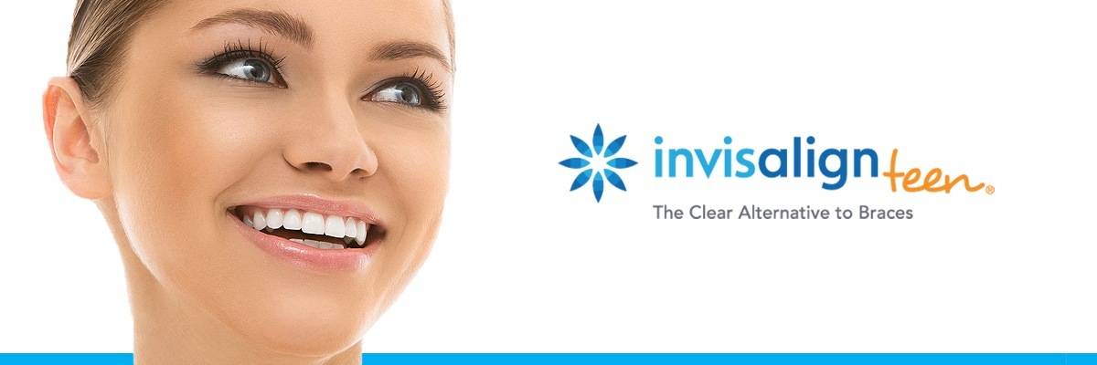 Rockville Invisalign vs Traditional Braces