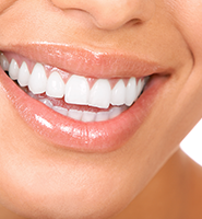 Teeth Whitening Services Rockville, MD