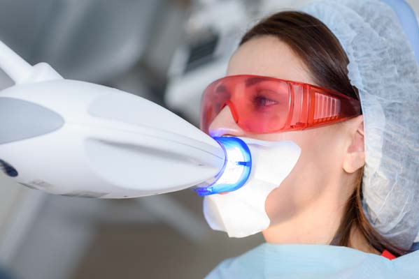 Tips For Teeth Whitening Aftercare