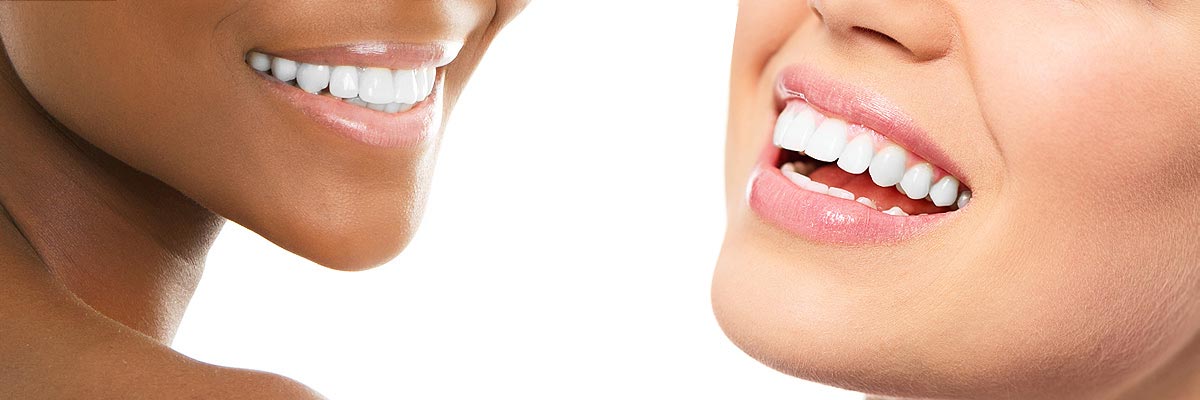 Rockville Teeth Whitening