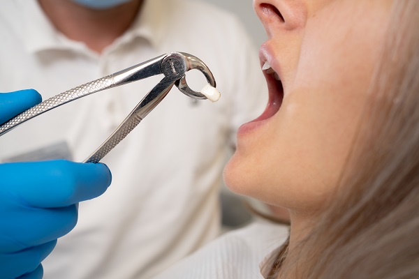 When You Should Get A Wisdom Tooth Extraction