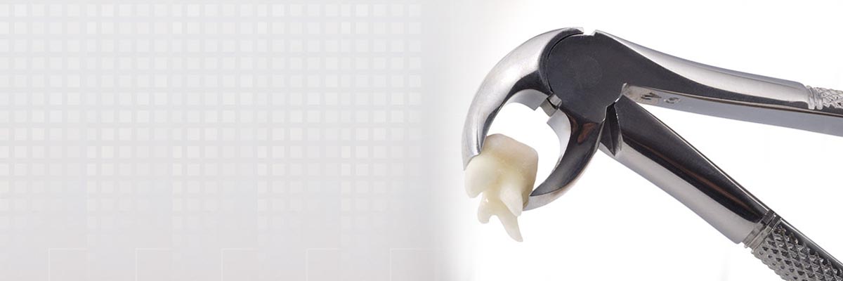 Rockville Tooth Extraction