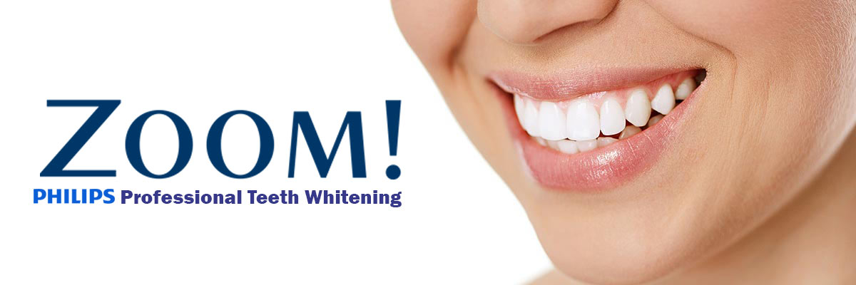 Rockville Zoom Teeth Whitening